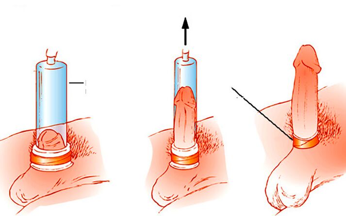 How the pumps work